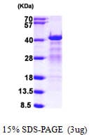 Human HNRNPC / HNRNP C Protein (Recombinant 6His, N-terminus)