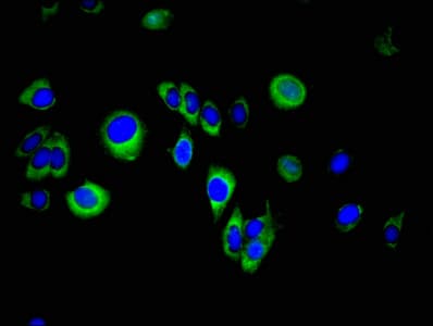 Polyclonal Rabbit anti-Human SPINT2 / HAI-2 Antibody (IF, WB)
