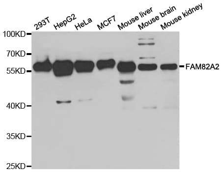 Polyclonal Rabbit anti-Human RMDN3 Antibody (IHC, WB)