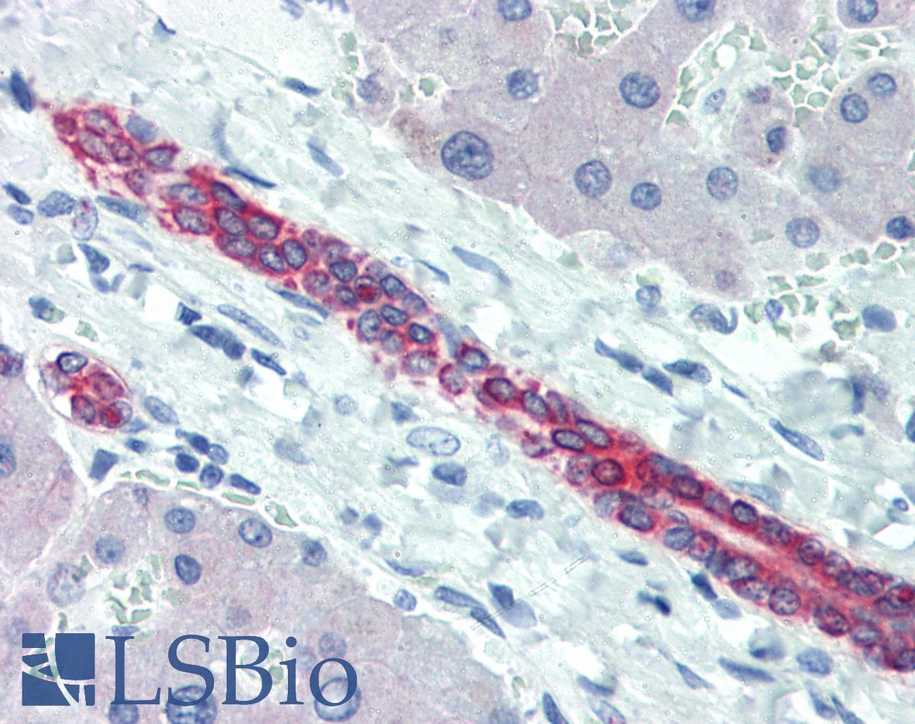 IHC-plus™ KRT8 / CK8 / Cytokeratin 8 Antibody (C-Terminus, clone R15-K)