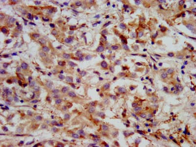 HMGCS2 / HMG-CoA Synthase 2 Antibody