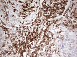 Monoclonal Mouse anti-Human DOCK2 Antibody (clone OTI7G2, aa1544-1830, IHC, WB)