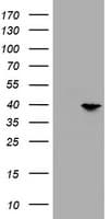 PRR11 Antibody (aa125-360, clone OTI1C1, Carrier-free)