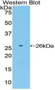 FGFR4 Antibody (aa168-369, Cy3)