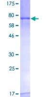 Human FGFR1OP / FOP Protein (Recombinant GST)