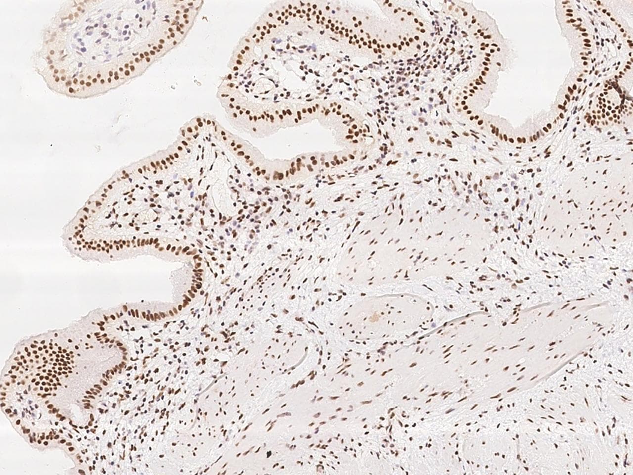 GPALPP1 / KIAA1704 Antibody