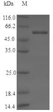 Human CYP11B2 / Aldosterone Synthase Protein (Recombinant 6His, N-terminus)