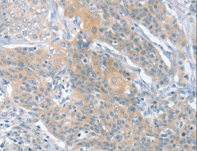 SLIT2 Antibody