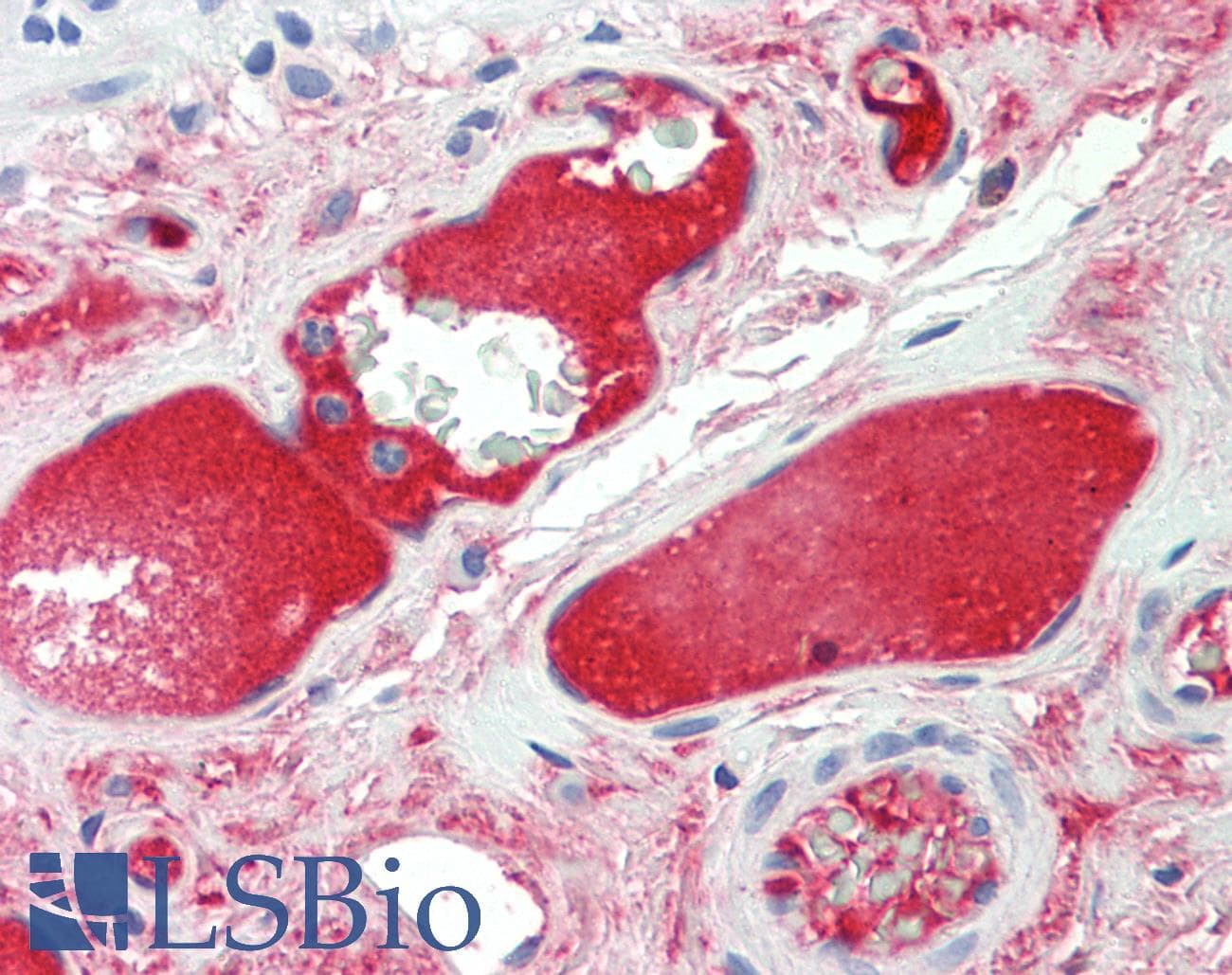 C4BPA / C4BP Alpha Antibody (C-Terminus)