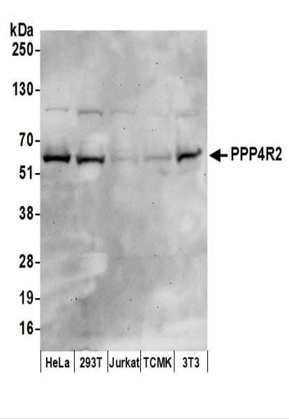 PPP4R2 Antibody (aa370-C-term)