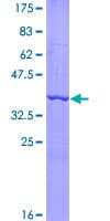 Human IL17A Protein (Recombinant GST, N-terminus)