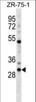 Polyclonal Rabbit anti-Human HOXD1 Antibody (aa14-42, WB)