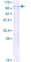 Human PADI4 / PAD4 Protein (Recombinant GST, N-terminus)