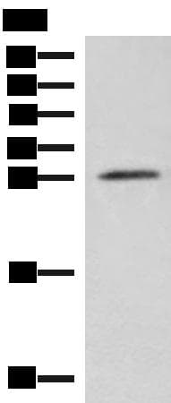 Polyclonal Rabbit anti-Human NIPSNAP3A Antibody (WB)
