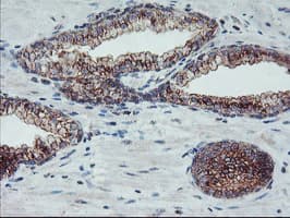 COPD / ARCN1 Antibody (clone OTI4H9)
