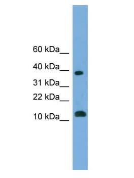 MGAT4D Antibody (aa107-156)