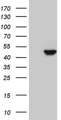 KRT16 / CK16 / Cytokeratin 16 Antibody (clone OTI2H8)