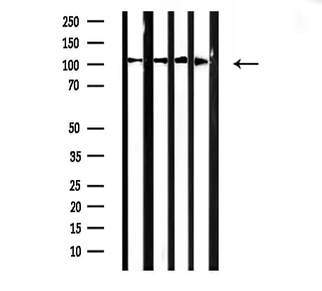 ACTN2 Antibody