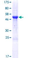 Human TMEM98 Protein (Recombinant GST)