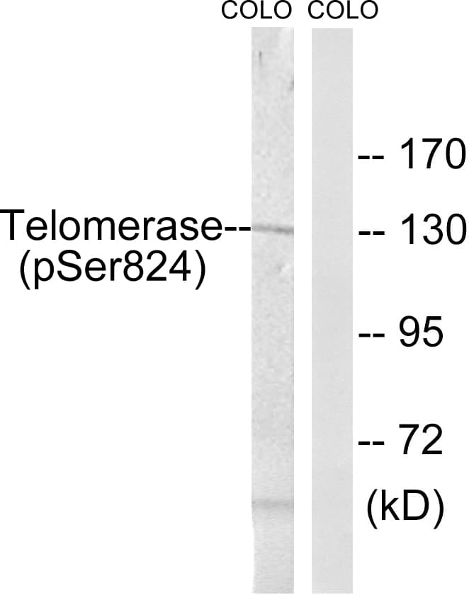 Polyclonal Rabbit anti-Human TERT / Telomerase Antibody (phospho-Ser824, WB)
