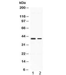 Polyclonal Rabbit anti-Human ABHD5 Antibody (IHC, WB)