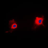 TP53I11 / PIG11 Antibody (Internal)