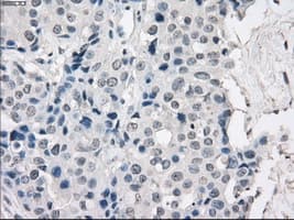 PRKAR1A Antibody (clone OTI6C7)