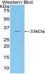 RORC / ROR Gamma Antibody (aa212-461)