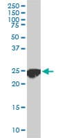 CLPP Antibody (clone 3E2)