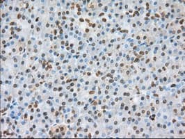 Basigin / Emmprin / CD147 Antibody (clone OTI4E4)