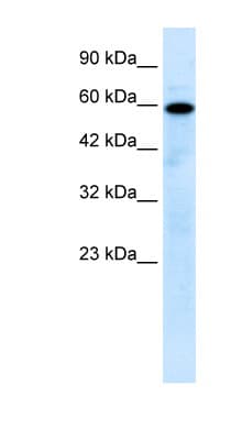 MCOLN1 / Mucolipin 1 Antibody (aa101-150, HRP)