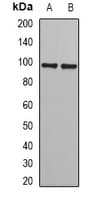 Polyclonal Rabbit anti-Human JADE1 / PHF17 Antibody (IF, WB)