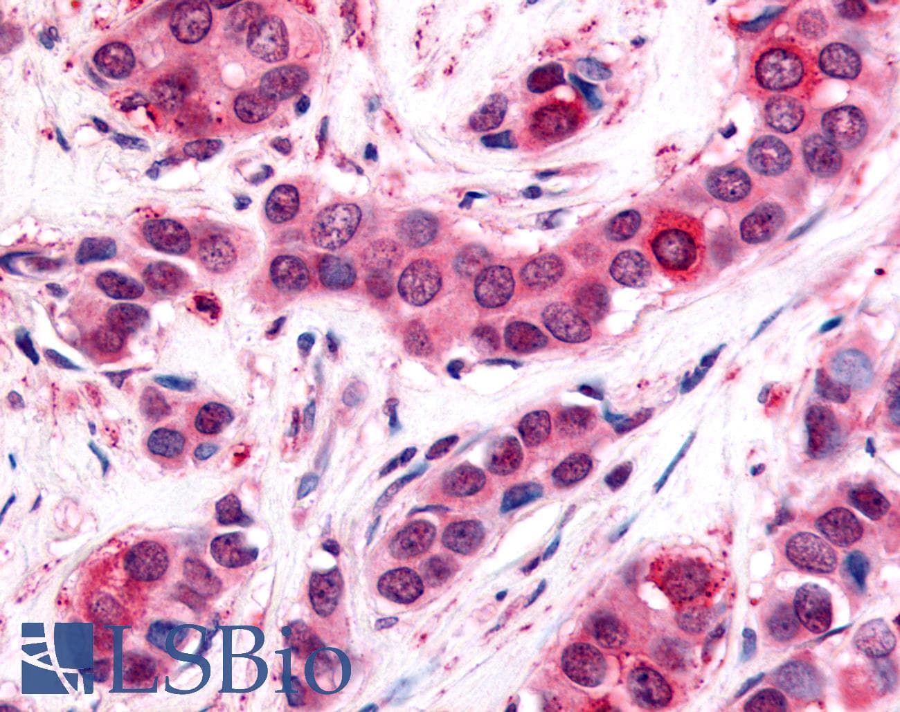 IHC-plus™ UCHL3 Antibody (C-Terminus)