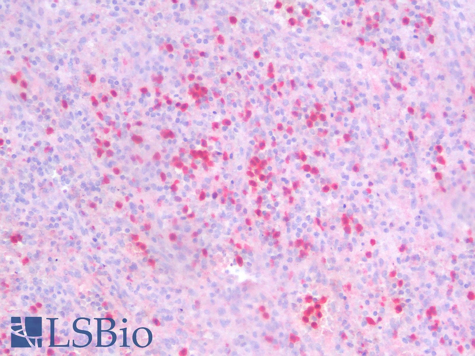 PathPlus™ SLC40A1 / Ferroportin-1 Antibody