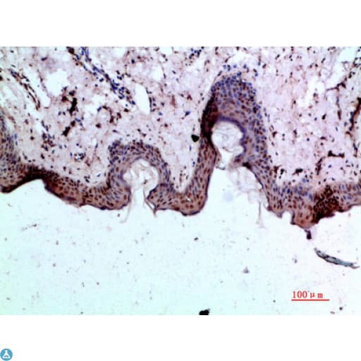 BMP1 Antibody