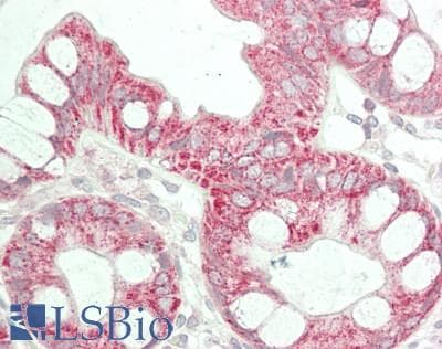 IHC-plus™ Polyclonal Rabbit anti-Human ENTPD5 / CD39L4 Antibody (aa333-362, IHC, WB)