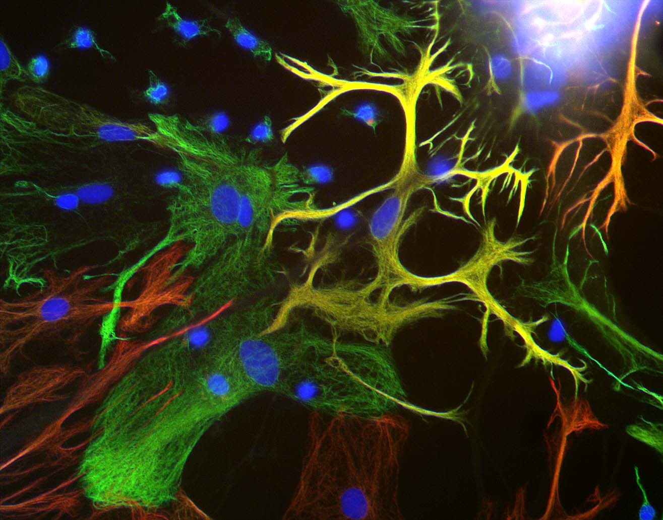 Vimentin Antibody