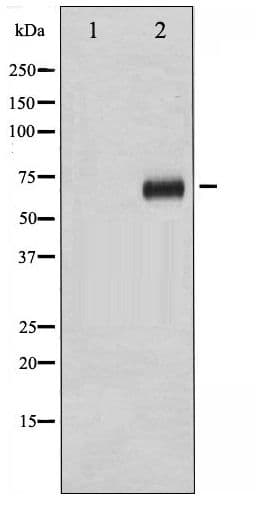 Polyclonal Rabbit anti-Human RPS6KB1 / P70S6K / S6K Antibody (phospho-Ser411, WB)