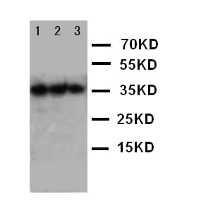 EPO / Erythropoietin Antibody (aa1-166)