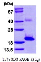 Human SNTN Protein (Recombinant His)