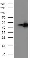 PPARA / PPAR Alpha Antibody (clone OTI2F3)