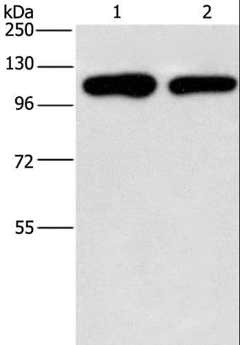 PIP5K1C Antibody