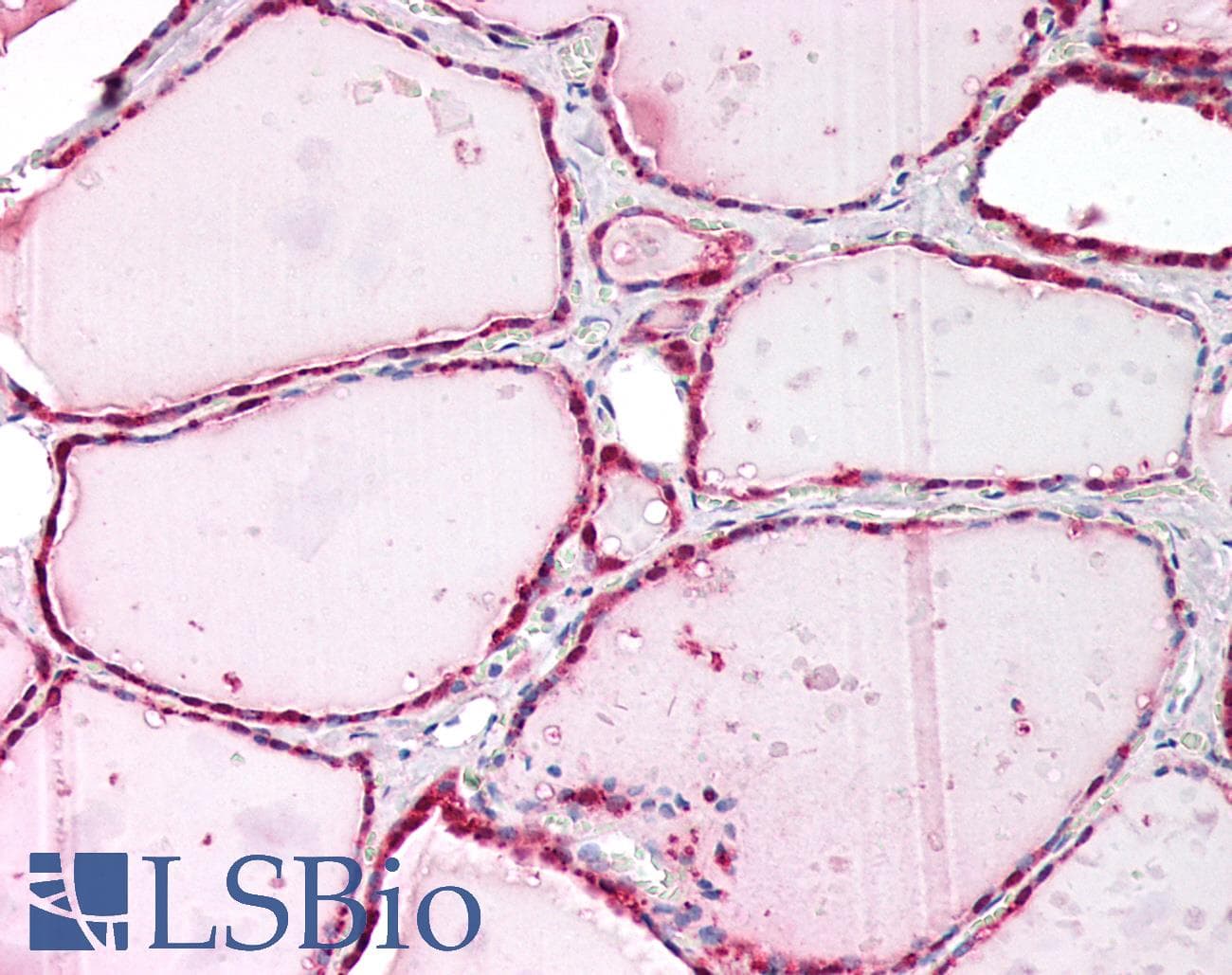 IHC-plus™ Polyclonal Rabbit anti-Human CRBN / Cereblon Antibody (IHC, WB)