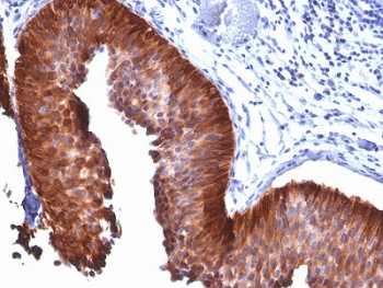 KRT17 / CK17 / Cytokeratin 17 Antibody (clone E3, Azide-free, BSA-free)