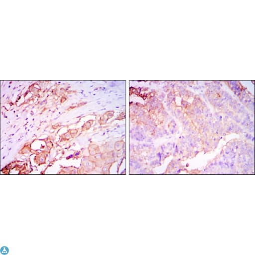CEACAM5 / CD66e Antibody