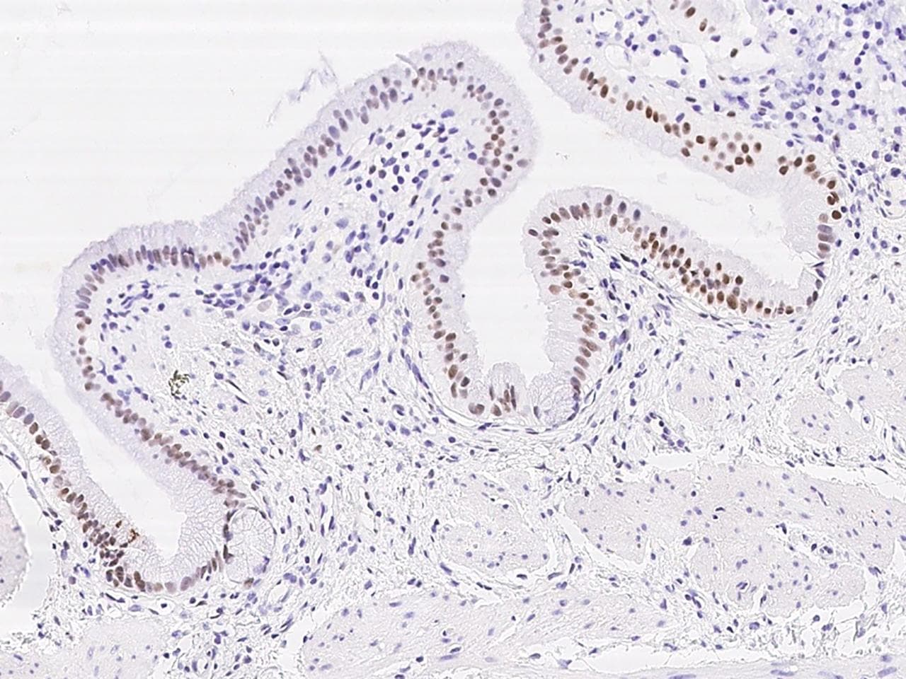DACH / DACH1 Antibody