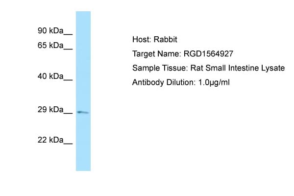 TGIF2 Antibody (C-Terminus)