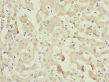Complement C8A Antibody (aa310-460)