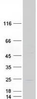 Human CRYGC / CCL Protein (Recombinant Myc-DDK (Flag))
