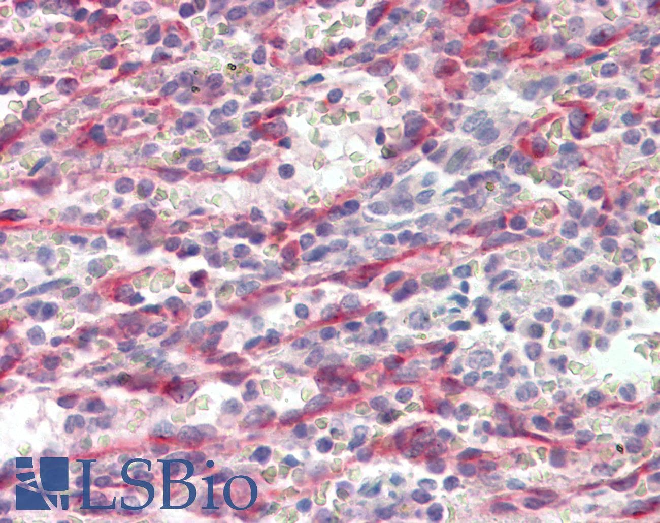 IHC-plus™ STAB1 Antibody (aa2559-2570)